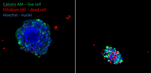 Colorectal cancer organoids