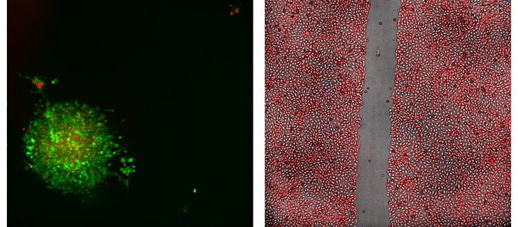 cell migration assay