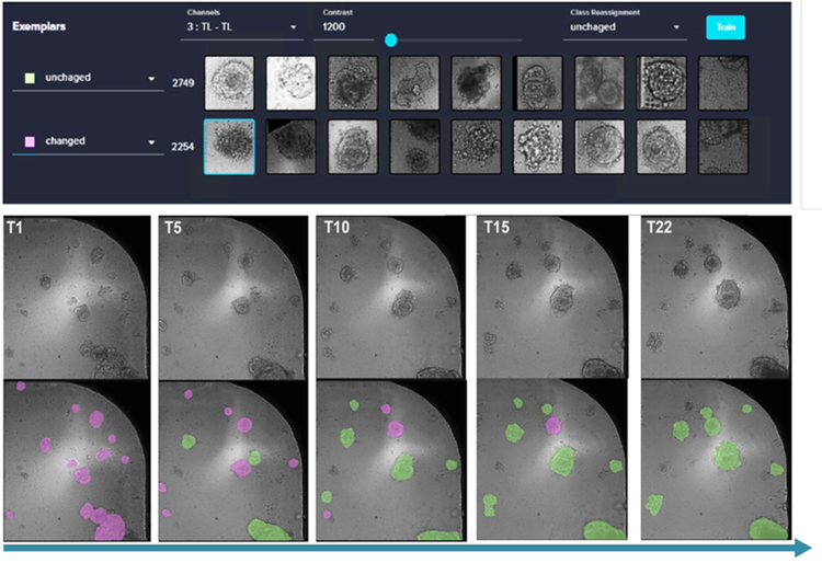 IN Carta® Image Analysis Software during the deep learning segmentation to easily generate masks for organoids and the machine learning