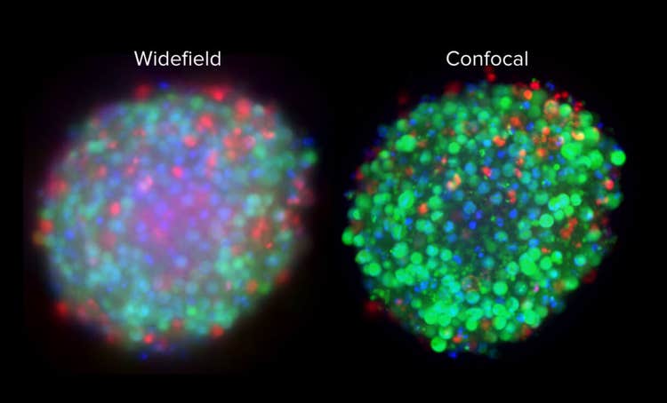 3D images Out-of-focus Light