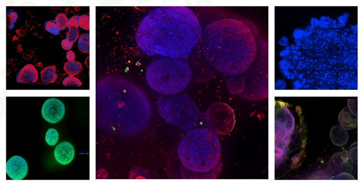 cellular Organoid Image