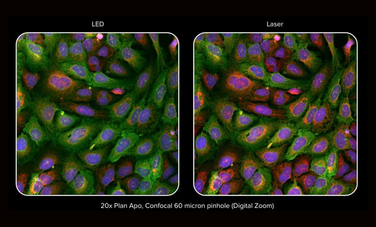 3D laser scanning Long Acquisition Time