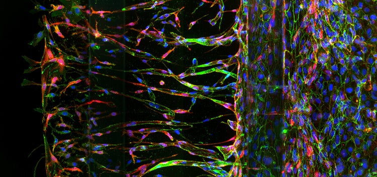 Angiogenic sprouts in OrganoPlate