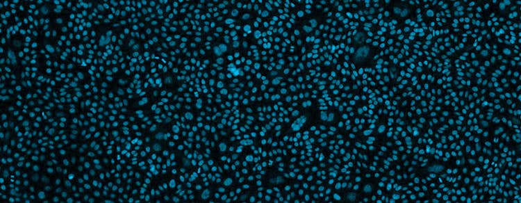 The evolution of CHO cells’ in cell line development