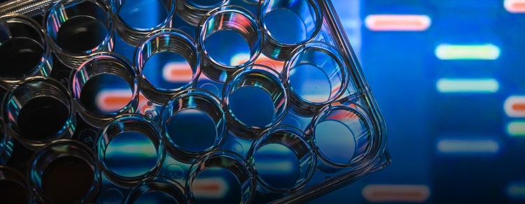 cell line development