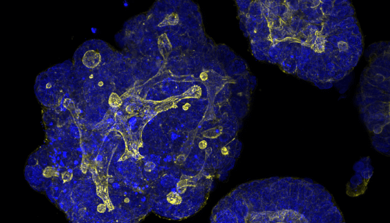 Are organoids the future of Drug Discovery