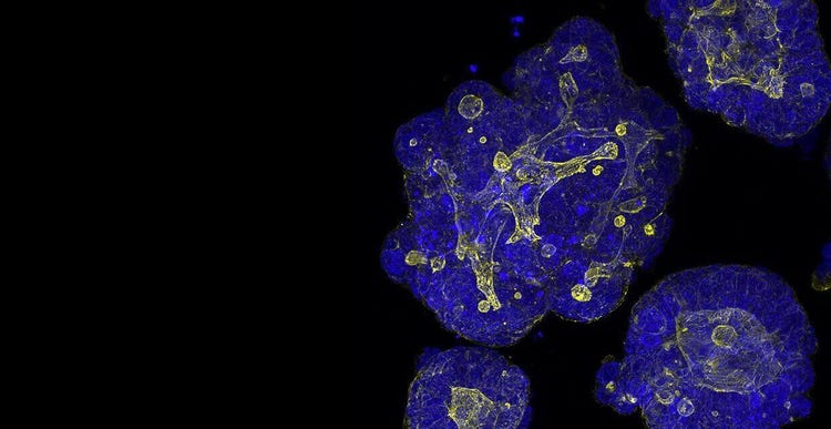 Proprietary patient-derived Organoid Technology