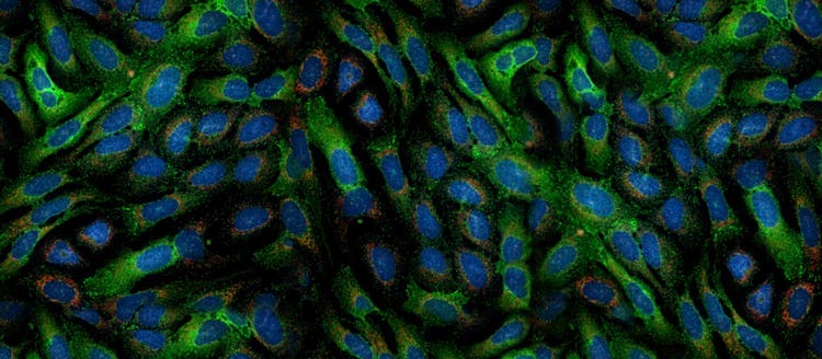 Cell Painting