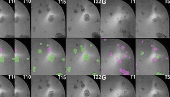 Organoids and AI