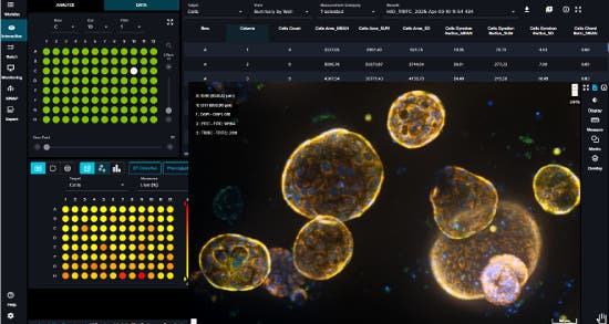 Challenges in Live-Cell Imaging of 3D Cell Cultures