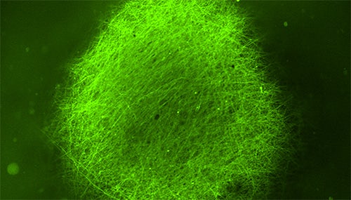 Brain organoid