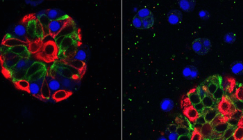 Mammary Organoid Research