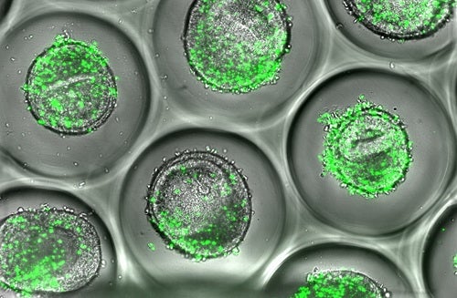 An image of human liver organoids co-cultured with autologous CD8 T cells (shown in green)