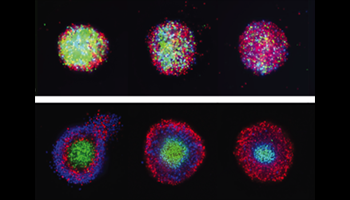 Disease modeling using novel flowchip system