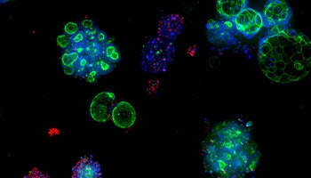 Organoids in Preclinical Testing