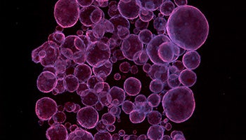 Organoid