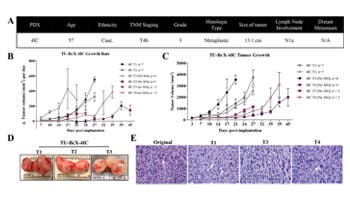 Patient-Derived Xenograft Model for Metaplastic Breast Carcinoma