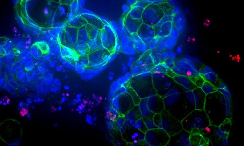 Growing organoids
