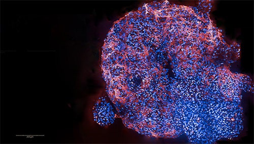 Human Cardiac Organoid