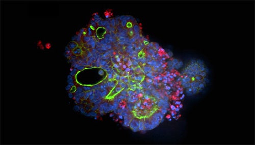 Organoid Culture Method