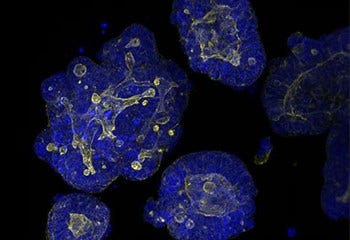 Custom Organoid Expansion Service