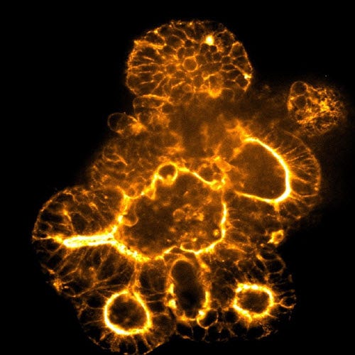 Organoid image acquired at 20X magnification