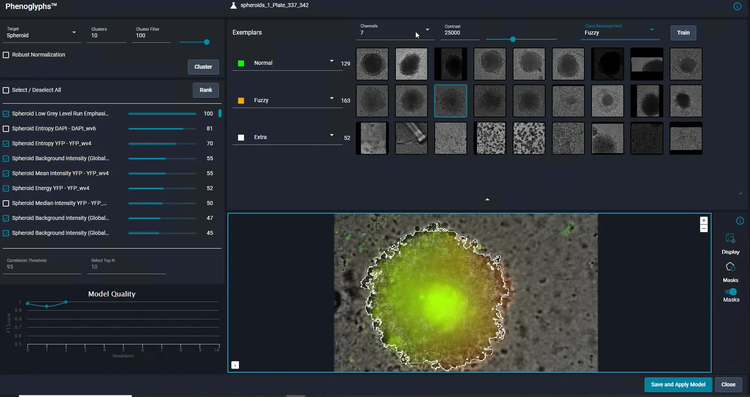 AI component of the ImageXpress HCS.ai High-Content Screening System supports image analysis