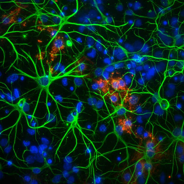 Micro Confocal High-Content Imaging System