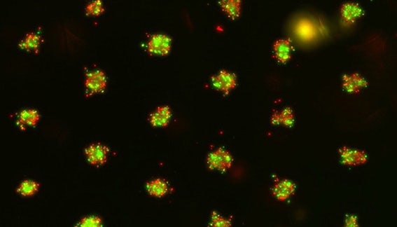 AI-enabled hit selection of drug screening on human pancreatic cancer organoids