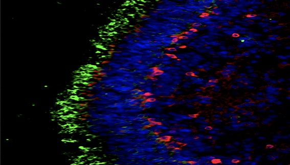 Photoreceptor Functional Activity in Retinal Organoids using Calcium Imaging