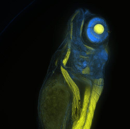 Zebrafish embryo acquired at 10X magnification