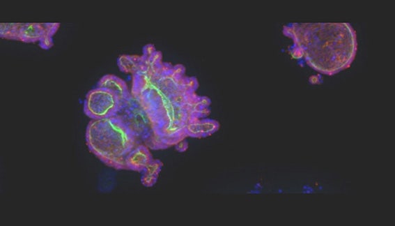 A microwell platform to standardize human rectal organoid cultures for high-content imaging and phenotypic analyses