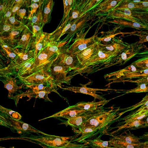 Cell painting assay at 60X magnification