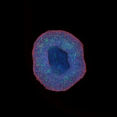 HepG2 spheroid acquired at 10X magnification