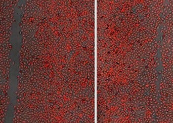 Cell Migration Assays