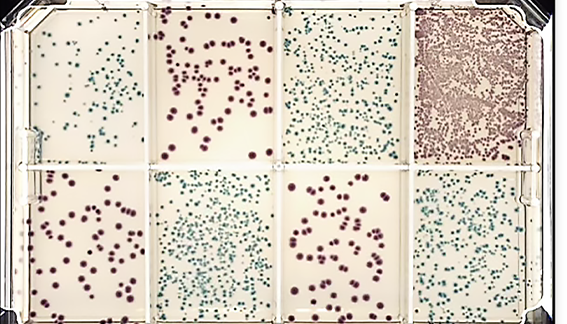 Microbial Screening & Selection | Molecular Devices