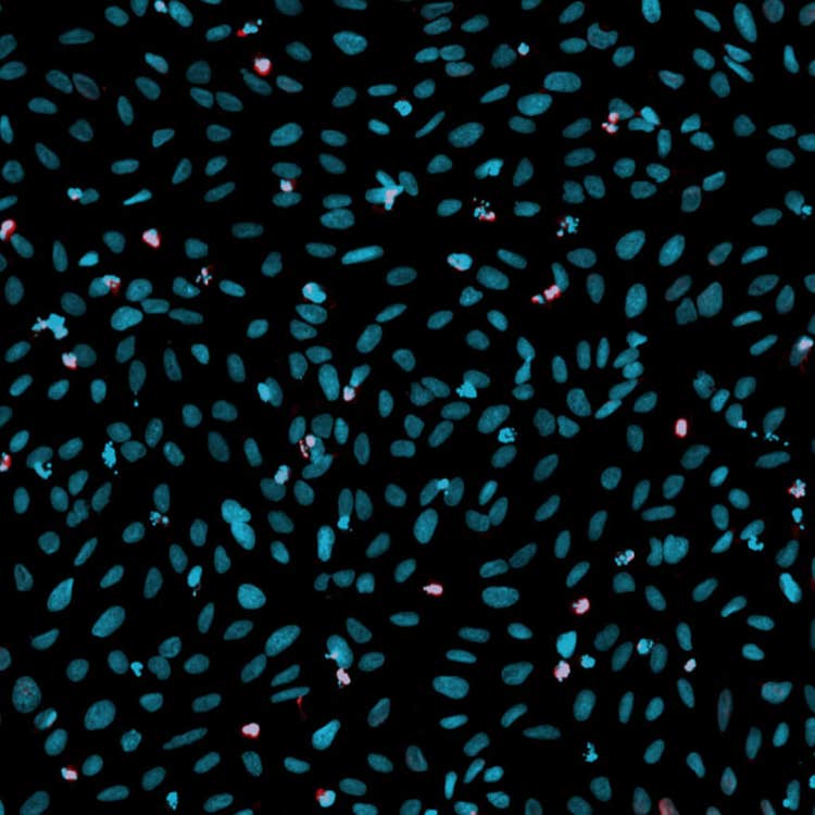 DNA damage overlay in U2OS cells using the ImageXpress Nano system