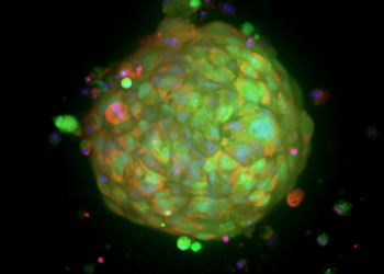 Patient-derived organoids (Tumoroids)