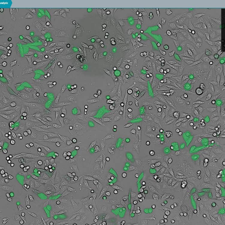 Transmitted light and GFP overlay using CellReporterXpress software on the ImageXpress Nano system