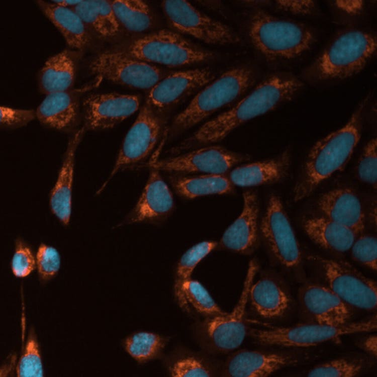 Mito toxicity with TRITC and DAPI using the ImageXpress Pico system