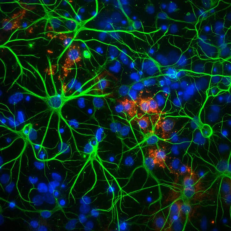 Neurons in 1536 well at 60X PA using the ImageXpress Micro Confocal system