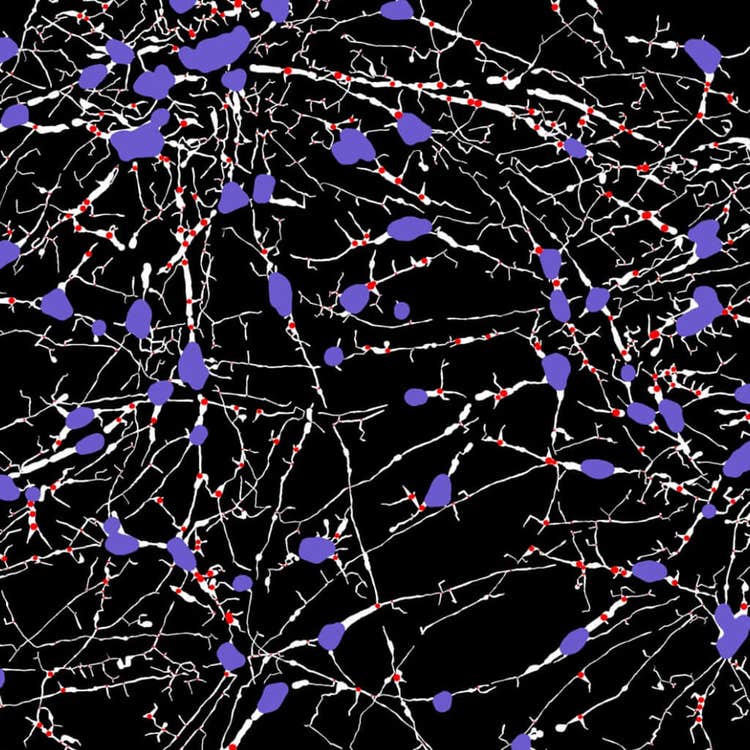 Stitched, neurite tracing mask at 40X using the ImageXpress Nano system