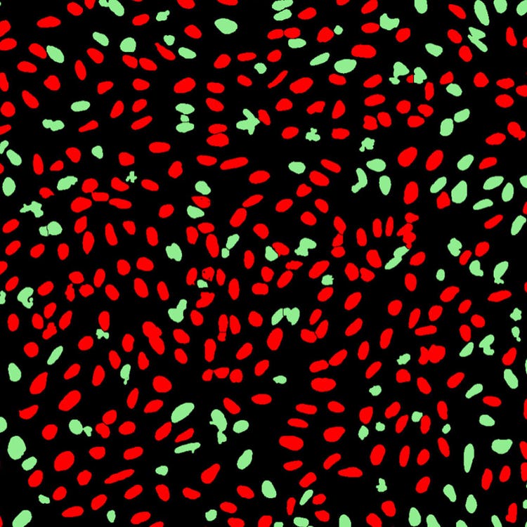 DNA damage mask in U2OS cells using the ImageXpress Nano system