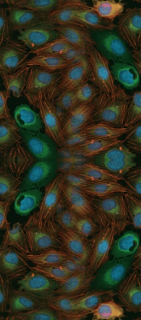 Cell Painting