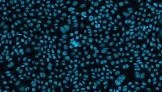 The Evolution of CHO Cells' Role in Cell Line Development