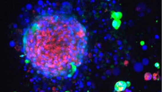 Image-based phenotypic profiling using Cell Painting in a 3D breast cancer spheroid model