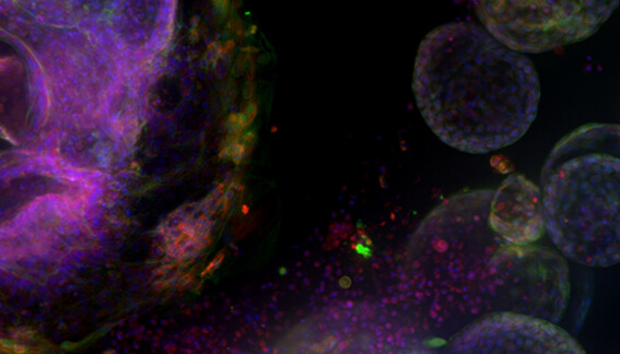 Building complexity in organoid models 