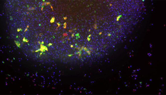 Automating high-throughput screens using patient-derived colorectal cancer organoids