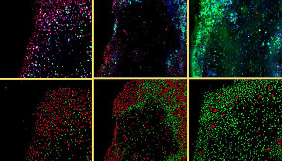 Automation of 3D bioprinting assays for high-content imaging and assessment of compound effects