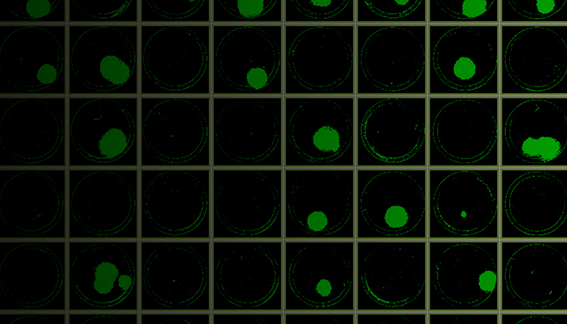 Automated workflow for screening of CRISPR-edited cell lines. High throughput screening and analysis of monoclonality.